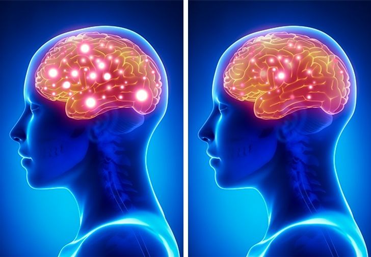 comparison between brains