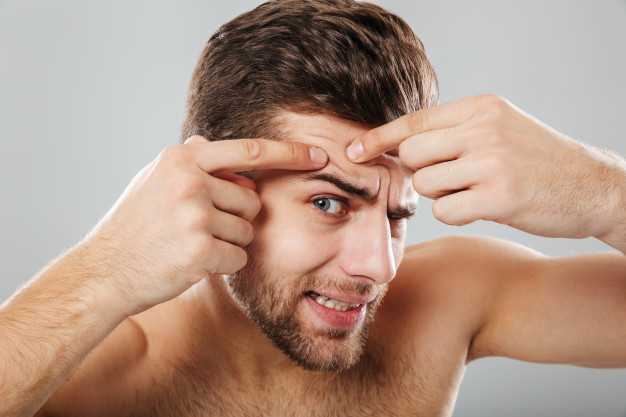 man squeezing pimple