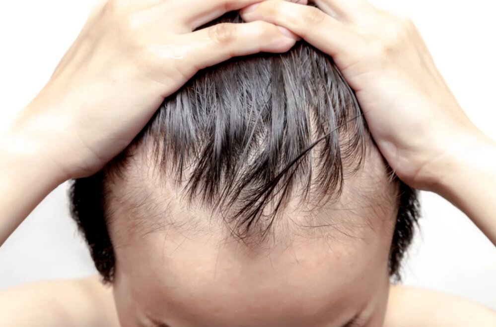 habits to avoid for men who want to have healthy hair