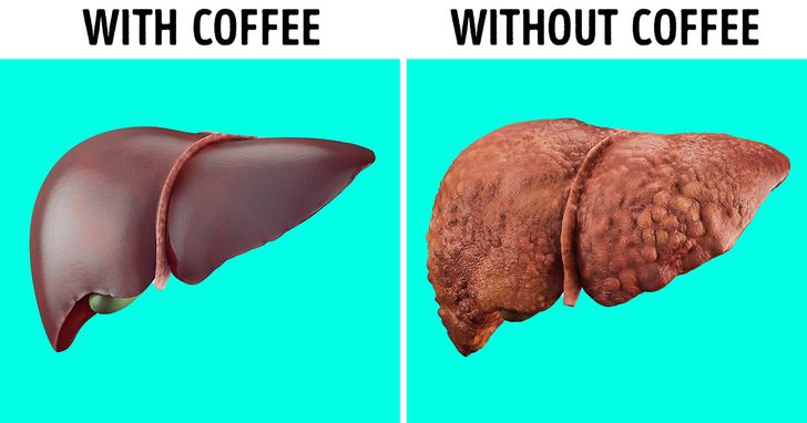 Drink more coffee for healthy gallbladder