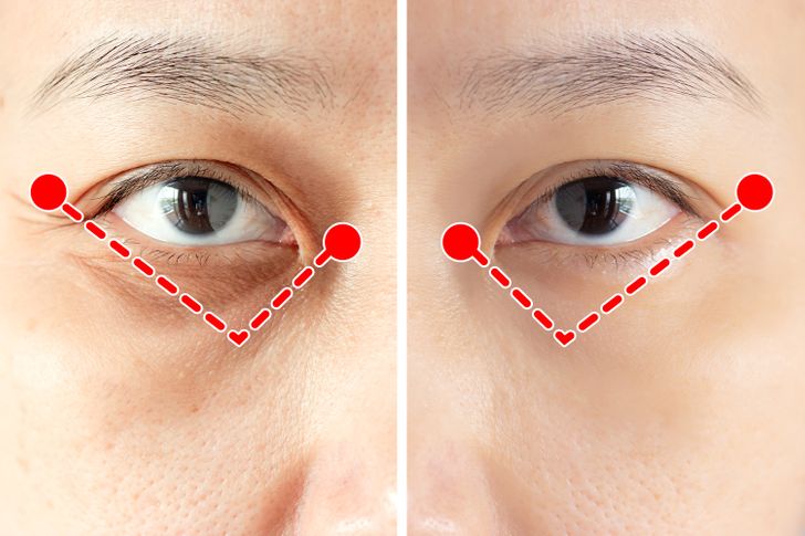 How to remove puffiness from under your eyes
