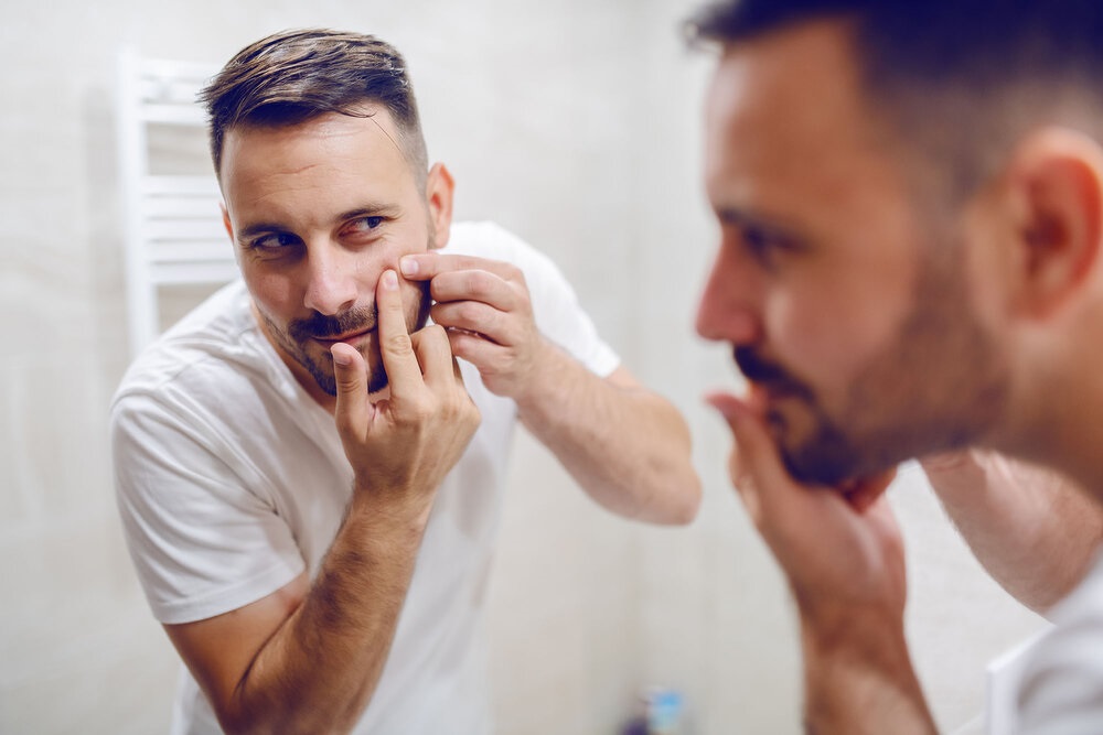 Close up of handsome caucasian man looking himself in the mirror and squeezing blackhead on his cheek