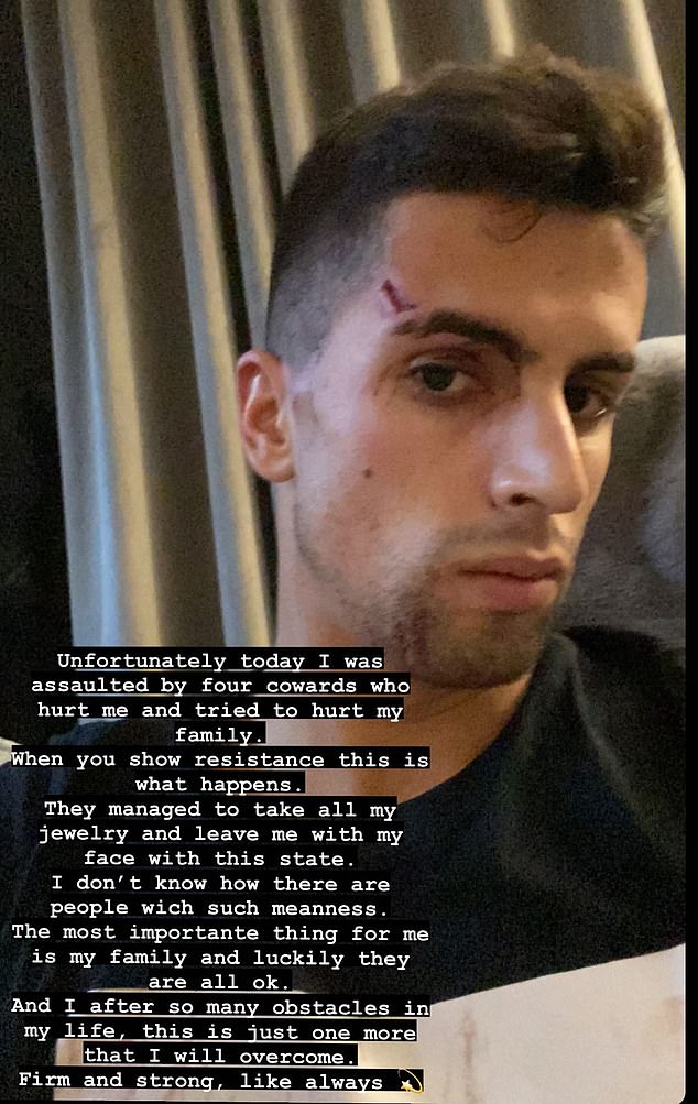 Manchester City defender Joao Cancelo reveals he was ATTACKED by 'four cowards who managed to take all my jewellery' while at home with his family... as police investigate after he suffered a nasty cut to his head 