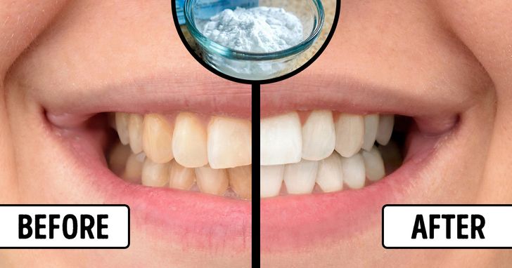 Natural teeth whitener