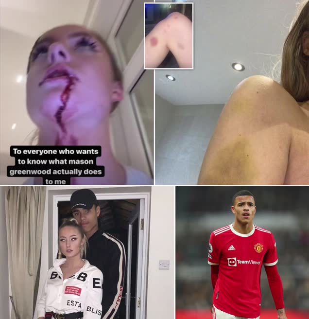 Man Utd star Mason Greenwood's girlfriend accuses him of beating her up
