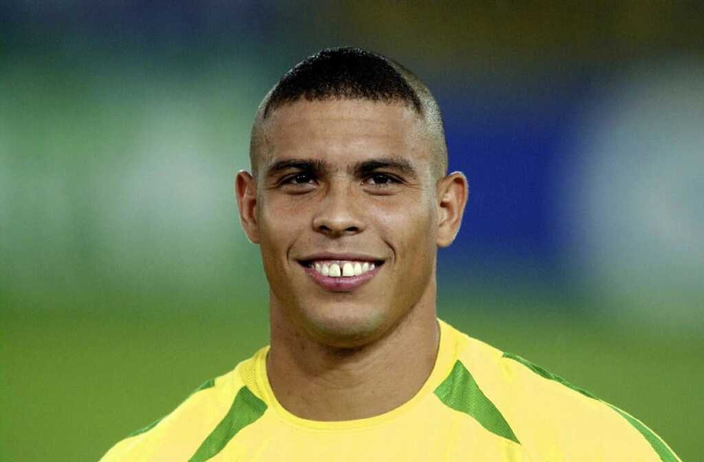 The-Ronaldo-Ugly-Haircut