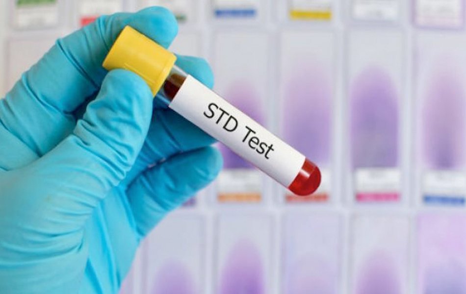 Sexually Transmitted Diseases