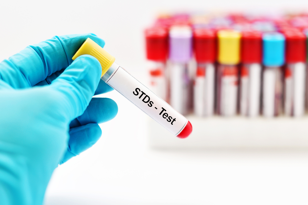 STD test