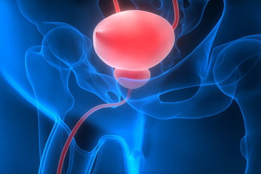 Overactive bladder