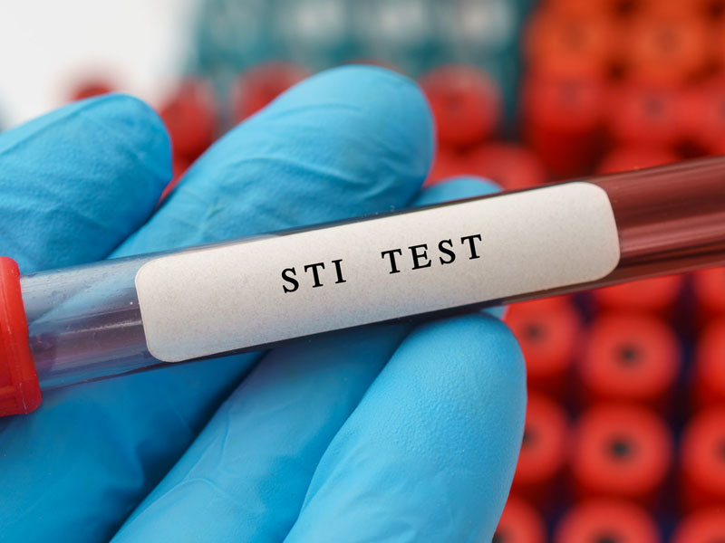 STI test