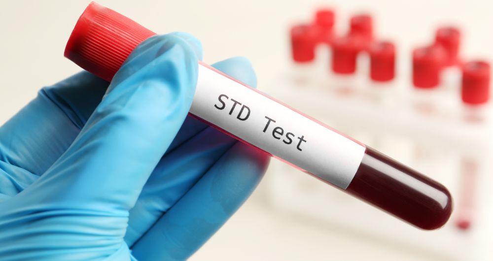  STI Tests 