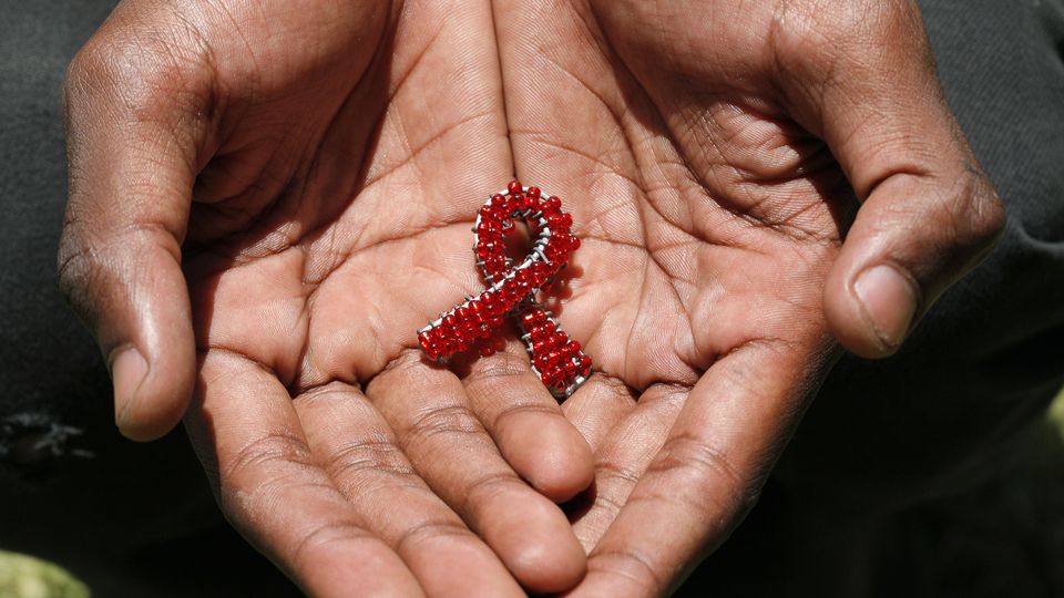 Acquired Immunodeficiency Syndrome (AIDS) 