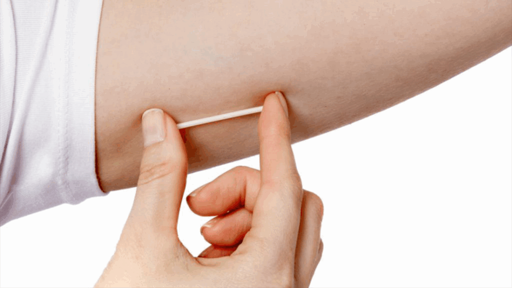 Implants 