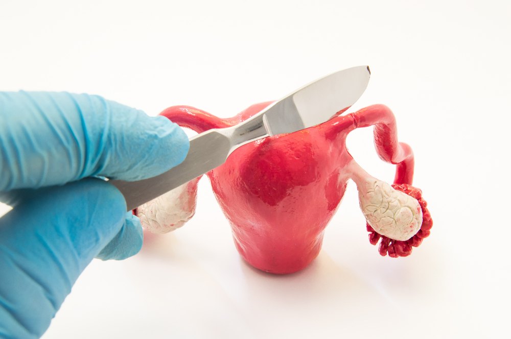 Sterilization
