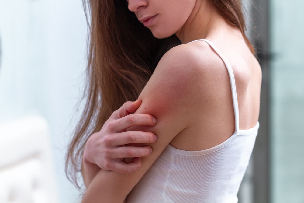 skin irritation 