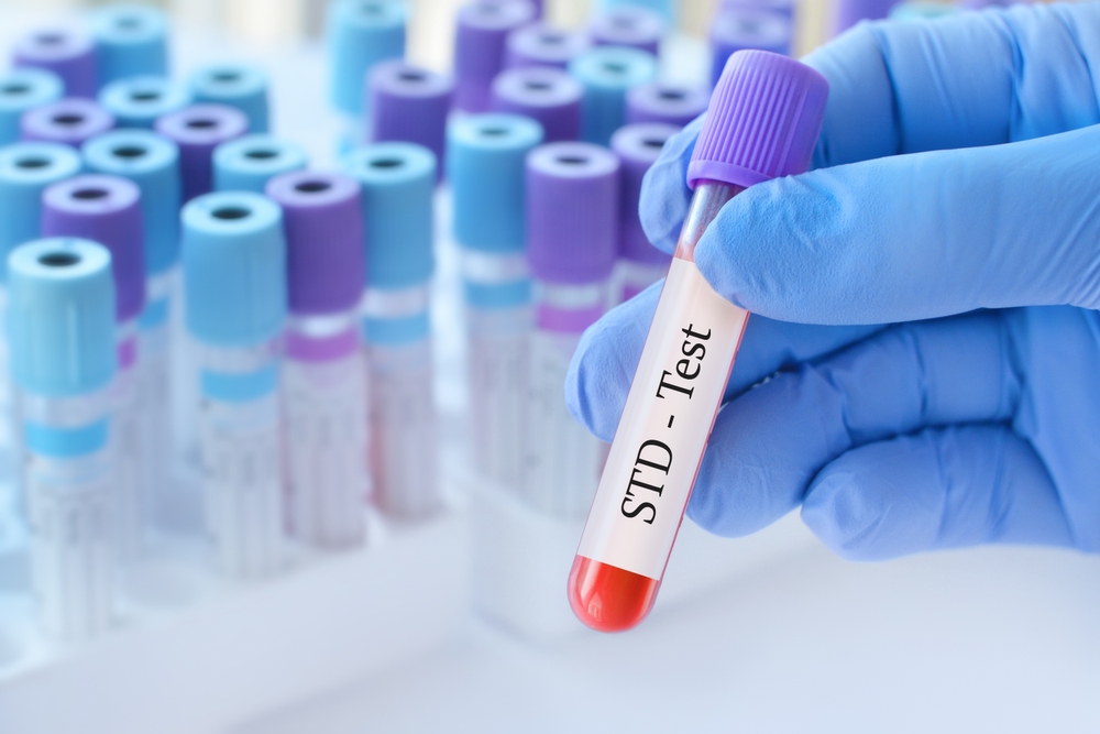STD Testing 