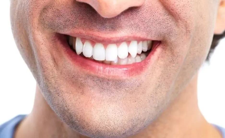 Oral Care Mistakes