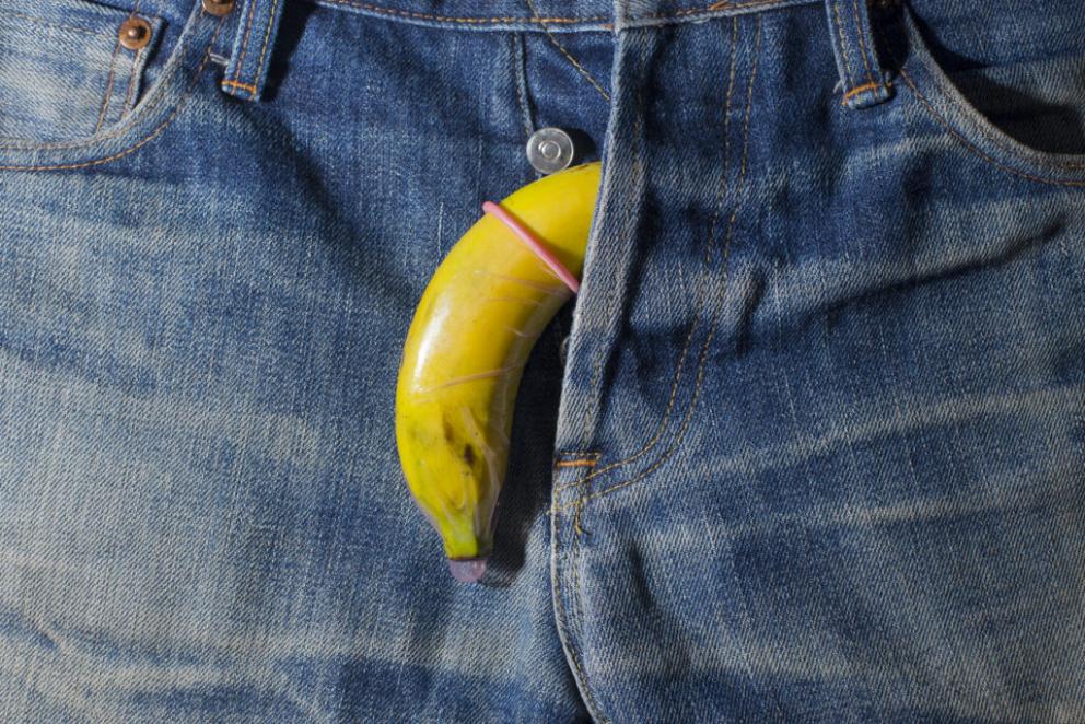  A purple or splotchy penis